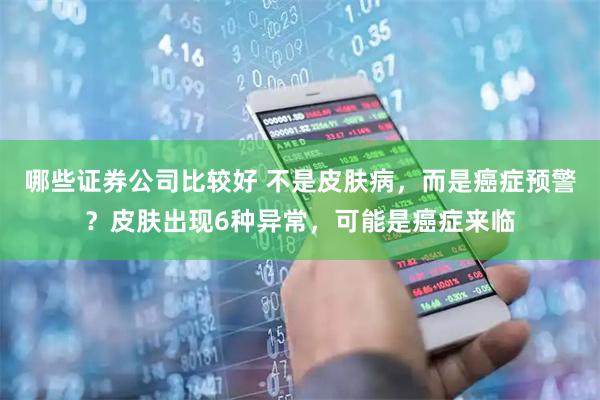 哪些证券公司比较好 不是皮肤病，而是癌症预警？皮肤出现6种异常，可能是癌症来临